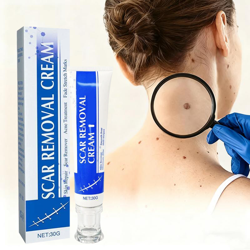 Scar Removal Cream